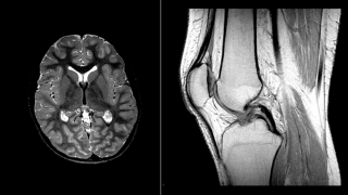 MRI Brain and Knee - Example Image