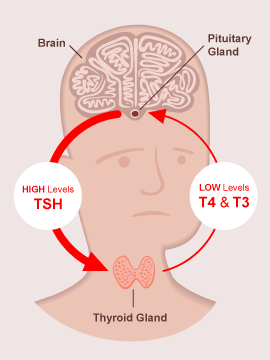 Hypothyroid Axis Image