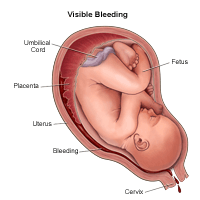 What Does Spotting or Bleeding in Early Pregnancy Mean? - WeHaveKids