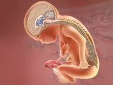 MOMS fetus repair illustration