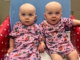 Newborn screening indicated Dean (left) and Danny (right) had Fabry disease