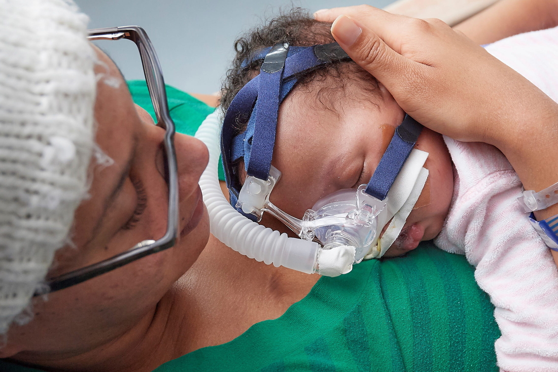 Baby wearing a non-invasive ventilation mask lying on mothers chest