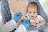 Doctor placing bandage on baby