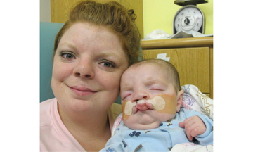 Neonatal Craniofacial Program | Children's Hospital of Philadelphia