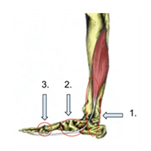 Flexor tendonitis outlet foot