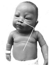 Measure distance to insert feeding tube.