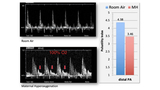 Doppler spectral display of blood flow chart