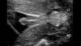 male genitalia ultrasound