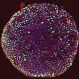 Colon organoid image