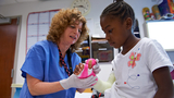 girl having cast applied to arm