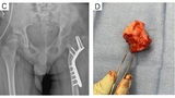 Figure 3: C &amp; D