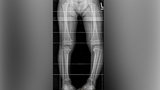 X-ray image