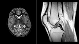 MRI Brain and Knee - Example Image