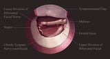 Anomalous facial nerve