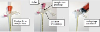 Remove feeding tube from package