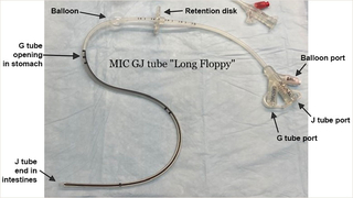 Long, floppy balloon GJ tube