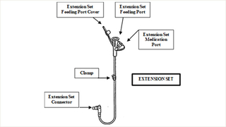 Extension set for button J tube