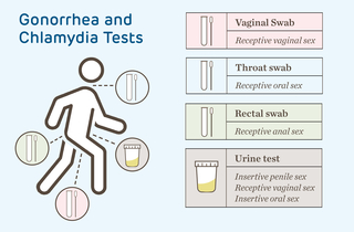 Gonorrhea and chlamydia test