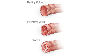 Cross sections of the colon illustration