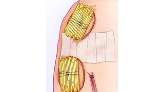 Foker - Close Up of Pads