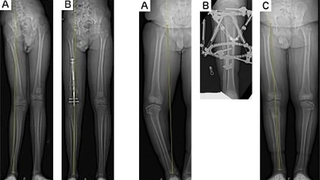 Figure 3 and 4