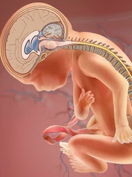 MOMS fetus repair illustration