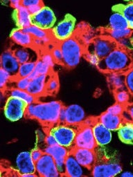 CRISPR-edited lung cells