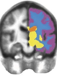 right brain image