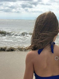 Girl on beach wearing patch