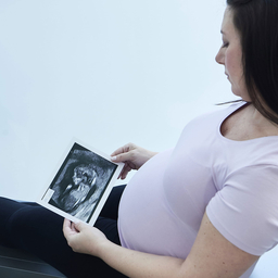 pregnant women with ultrasound photo