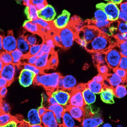 CRISPR-edited lung cells