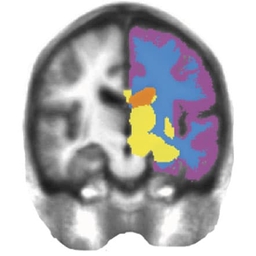 right brain image